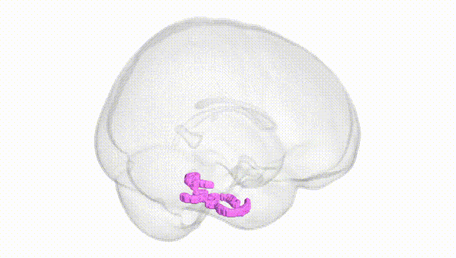 Full Brain White