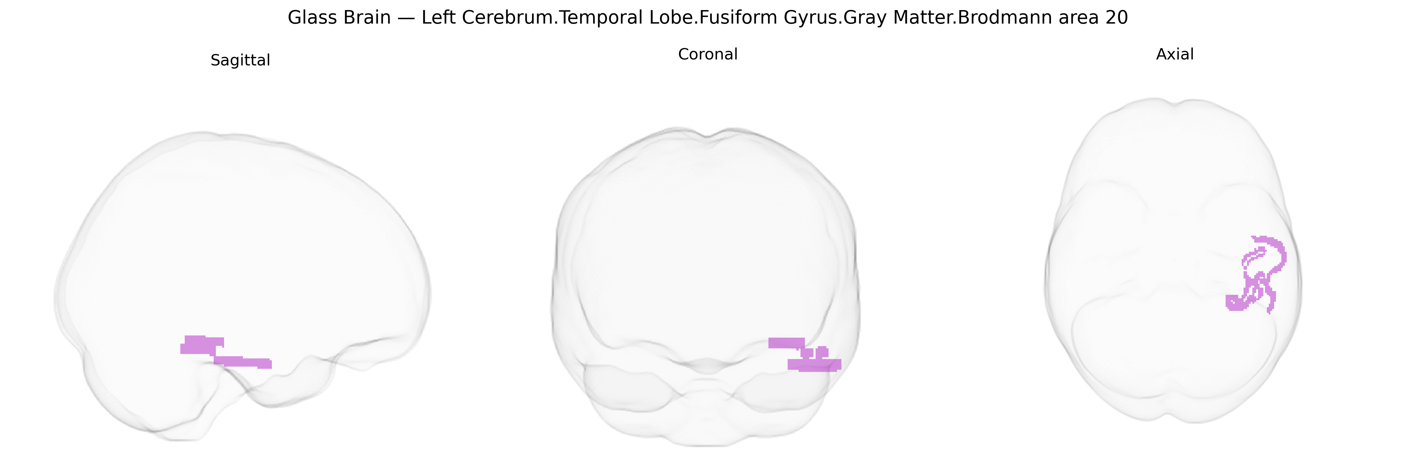 Triplanar Ghost Brain