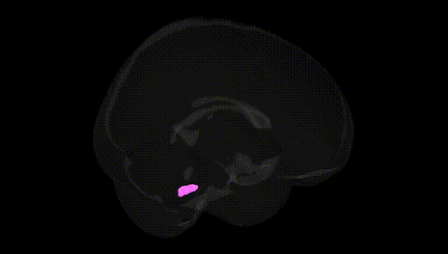 Full Brain Black