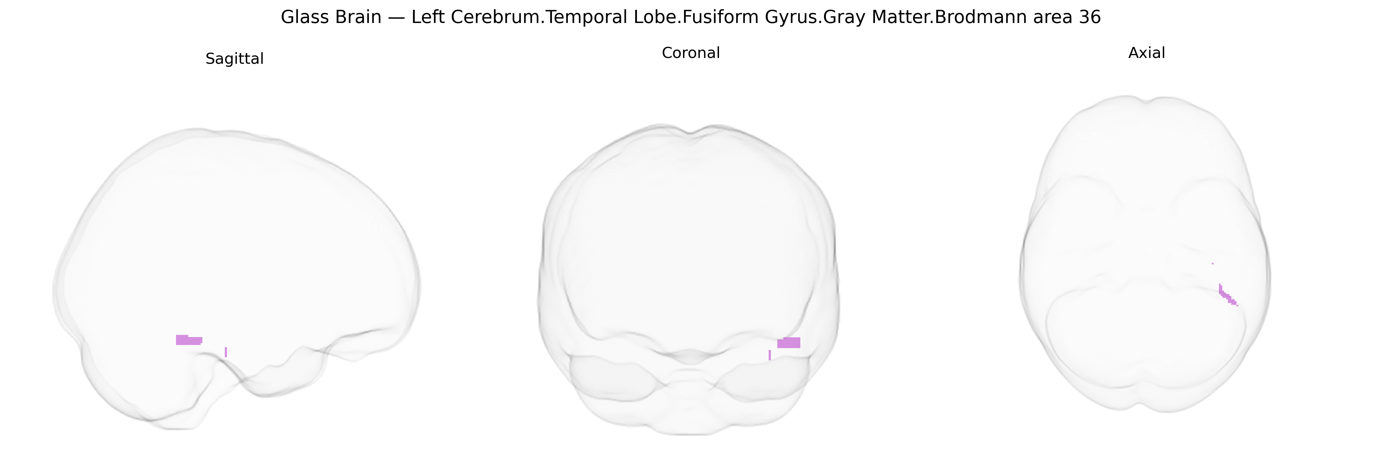 Triplanar Ghost Brain