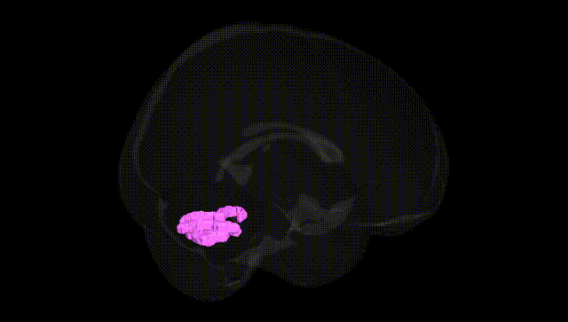 Full Brain Black