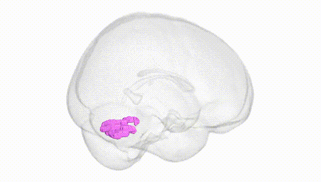 Full Brain White