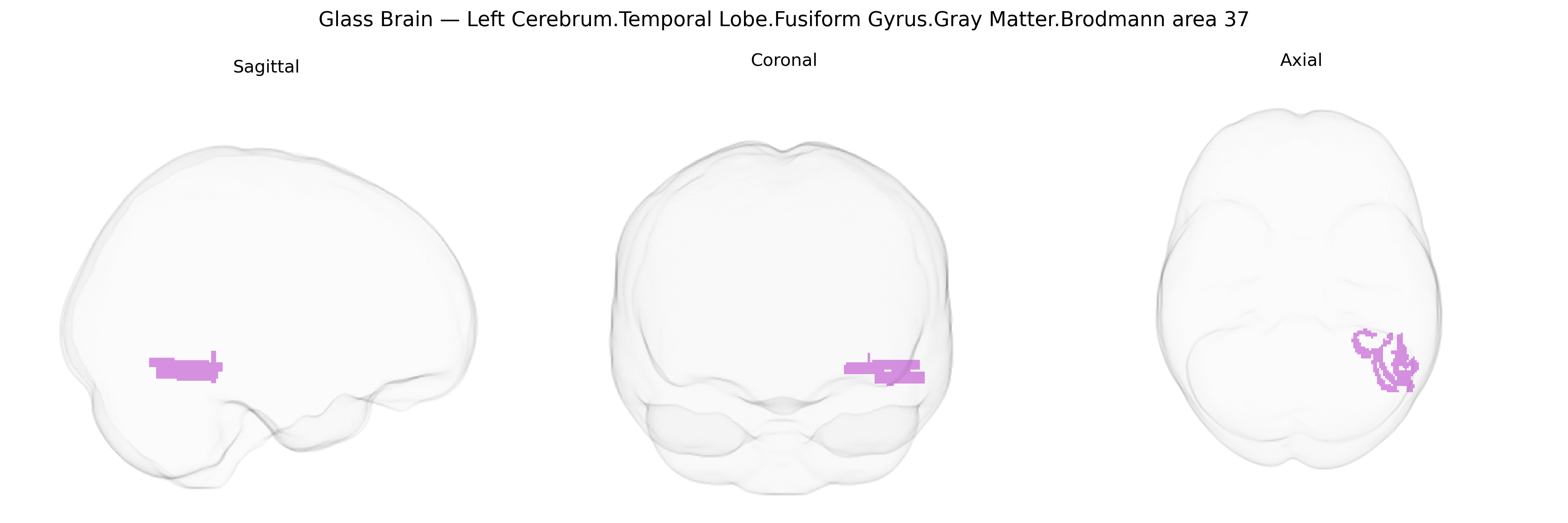 Triplanar Ghost Brain