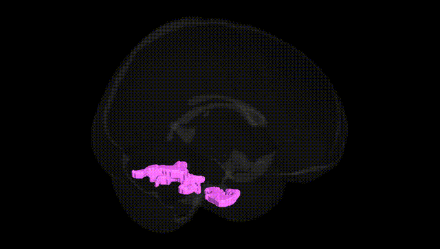 Full Brain Black