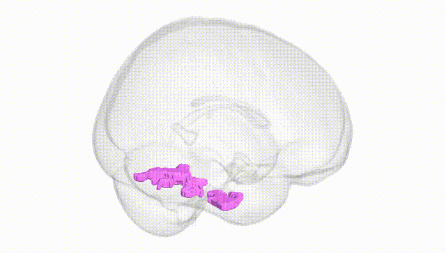 Full Brain White