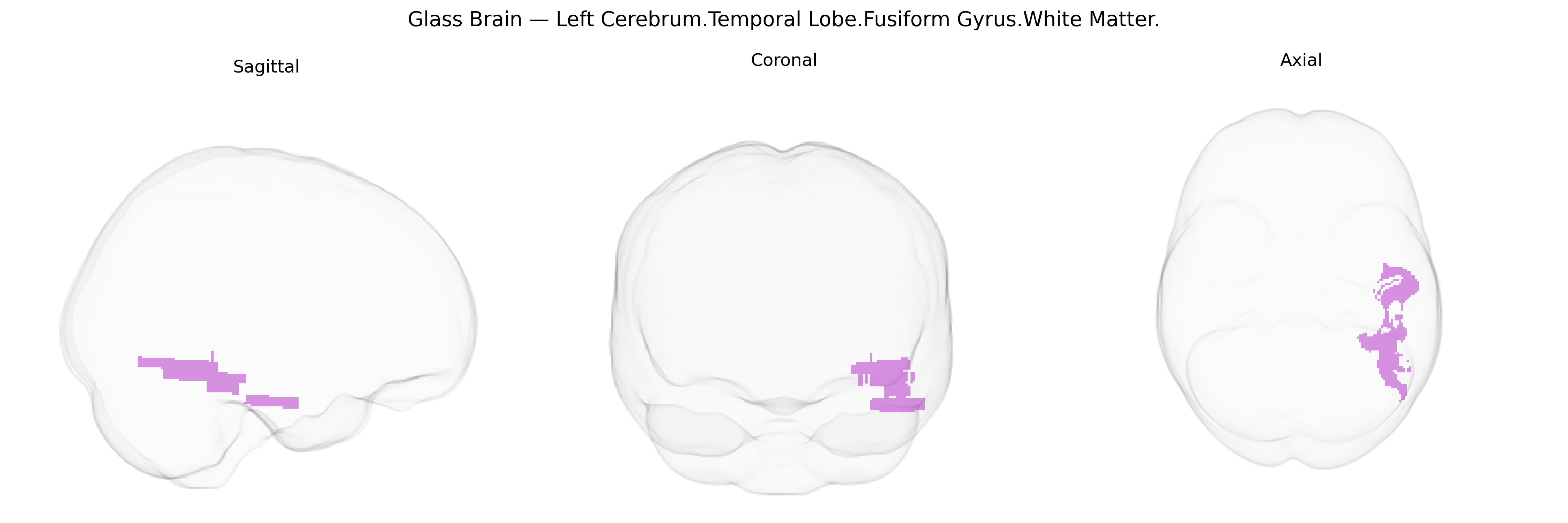 Triplanar Ghost Brain