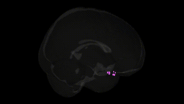 Full Brain Black