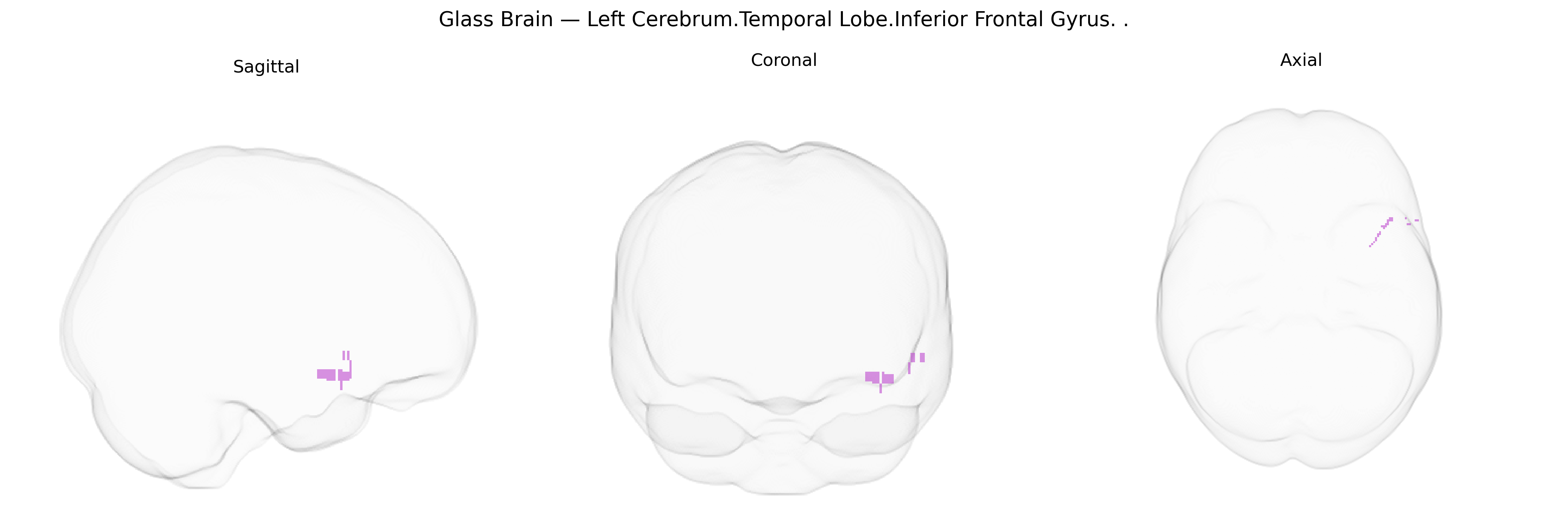 Triplanar Ghost Brain