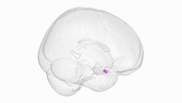 Full Brain White