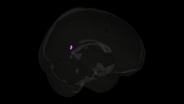 Full Brain Black