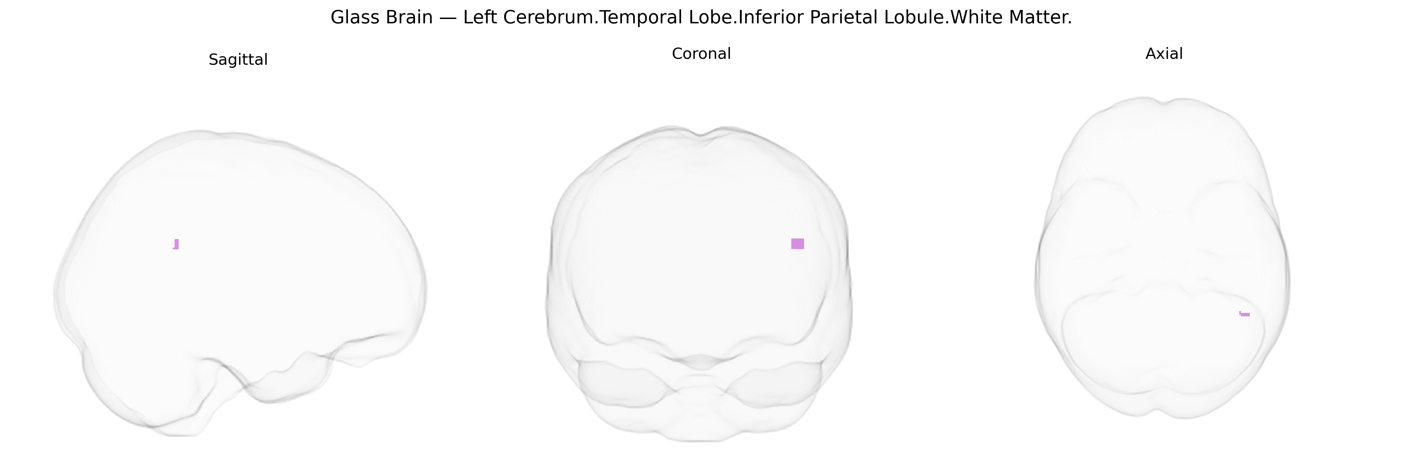 Triplanar Ghost Brain