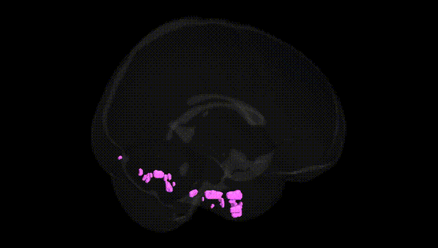 Full Brain Black