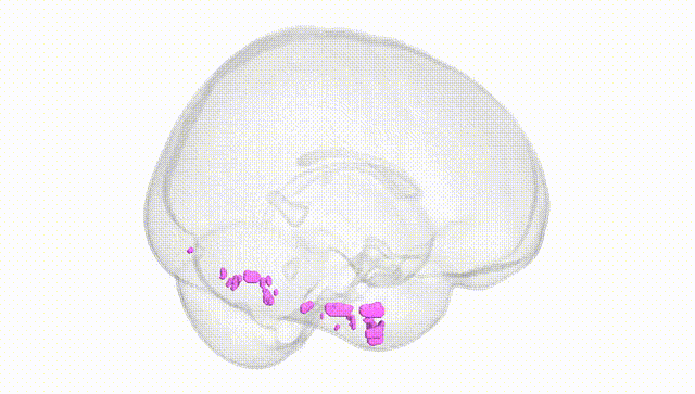 Full Brain White