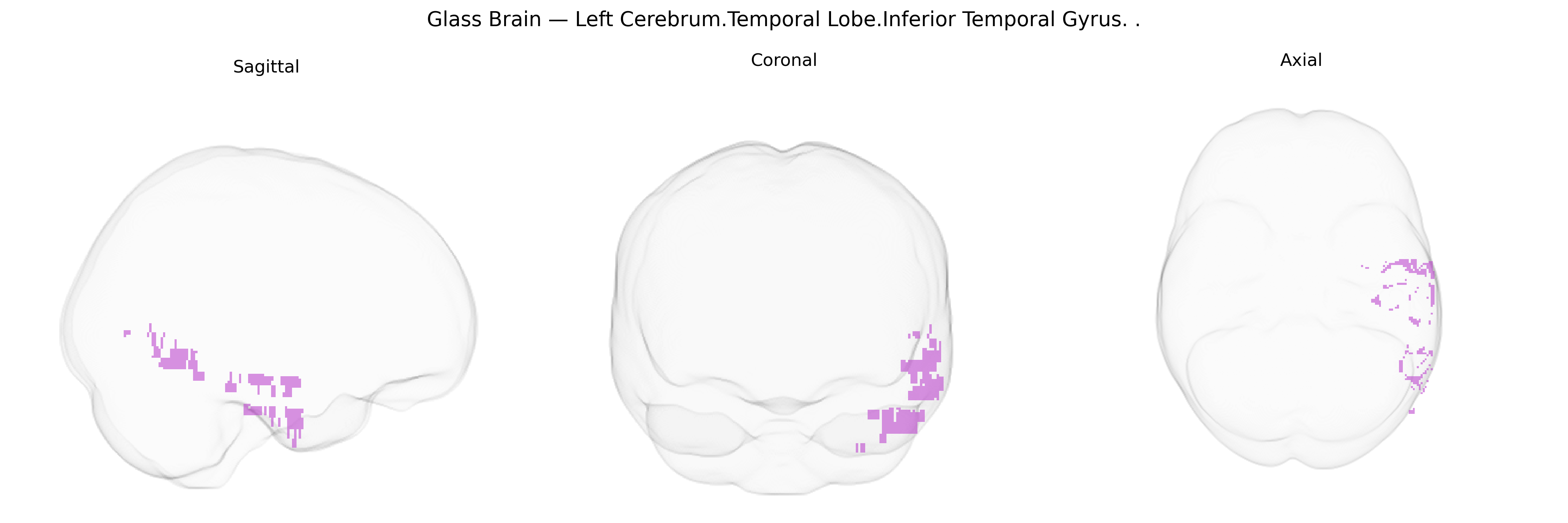 Triplanar Ghost Brain