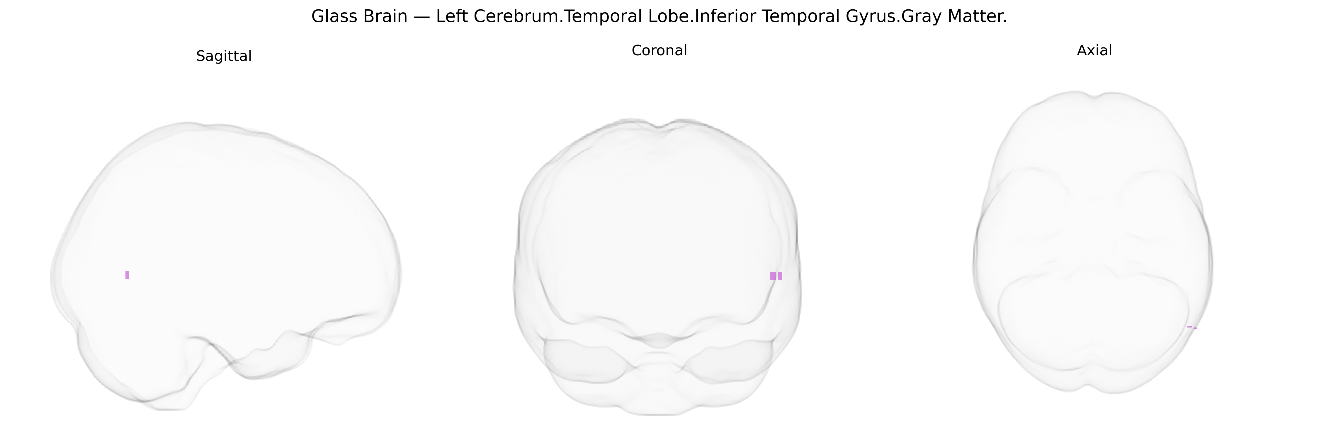 Triplanar Ghost Brain