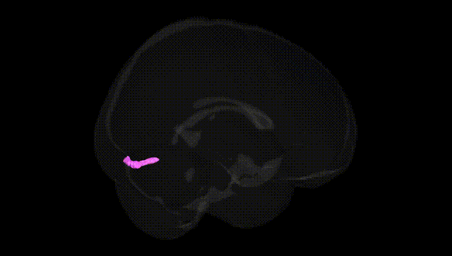 Full Brain Black