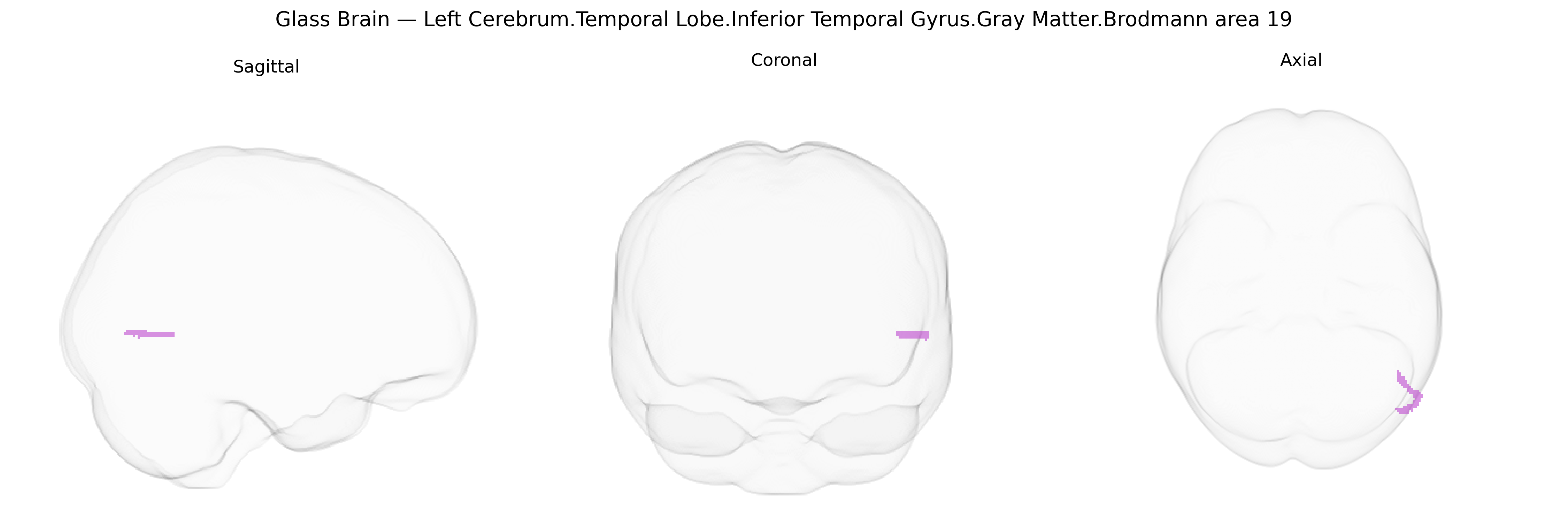 Triplanar Ghost Brain