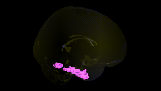 Full Brain Black
