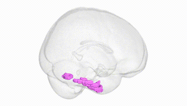 Full Brain White