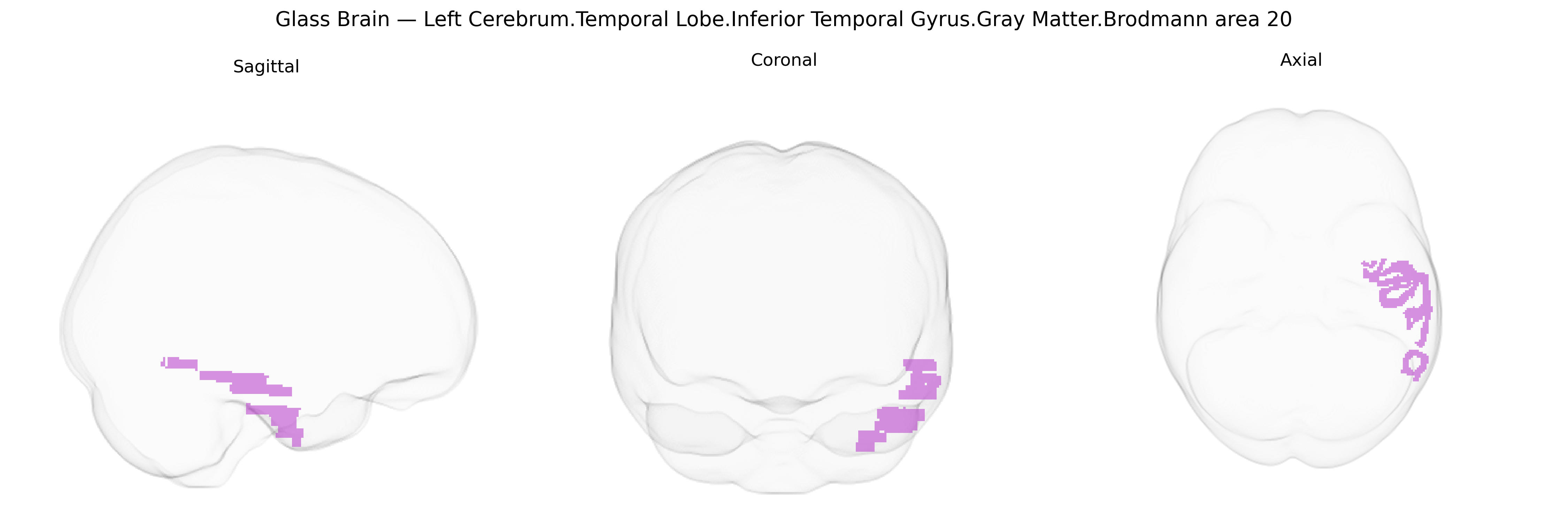 Triplanar Ghost Brain