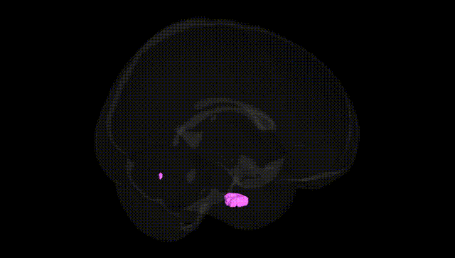 Full Brain Black