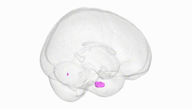 Full Brain White