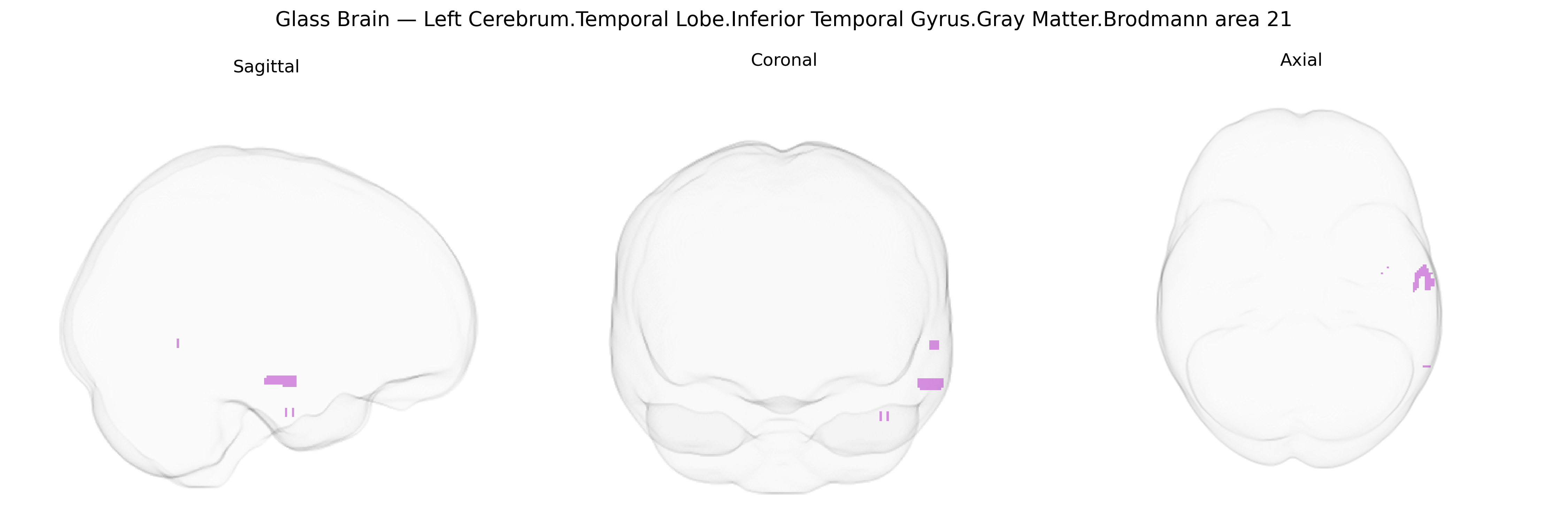Triplanar Ghost Brain