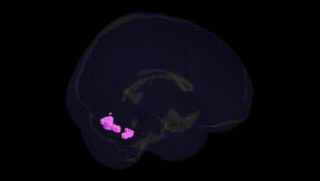 Full Brain Black