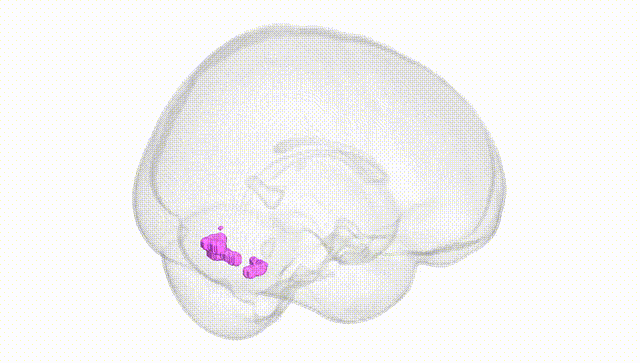 Full Brain White