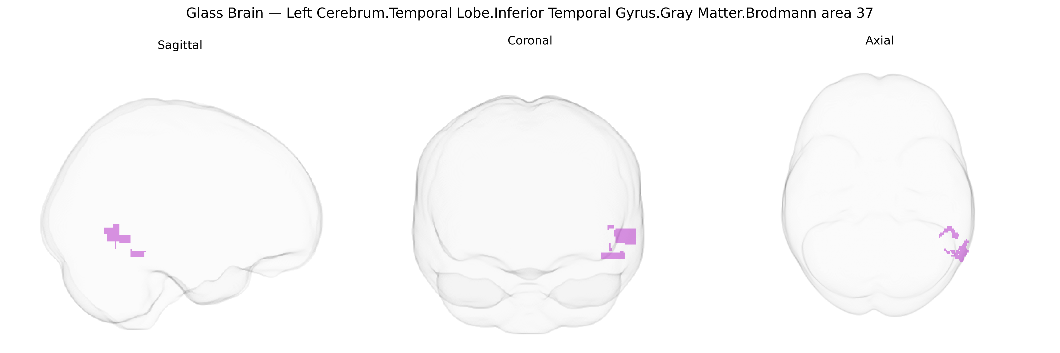 Triplanar Ghost Brain