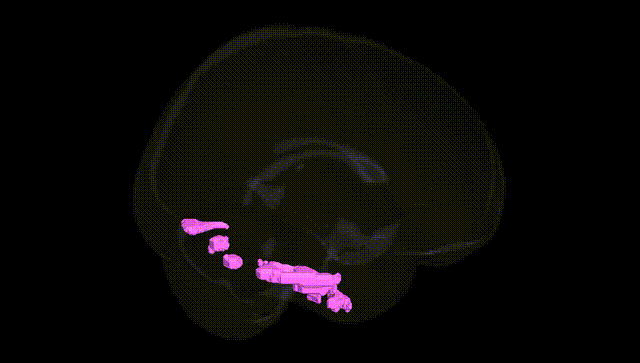 Full Brain Black