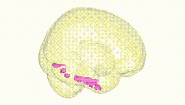 Full Brain White