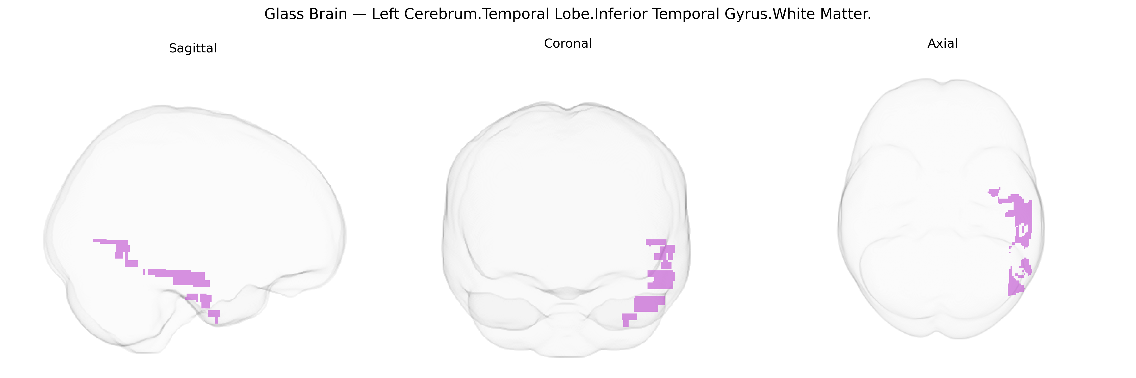 Triplanar Ghost Brain