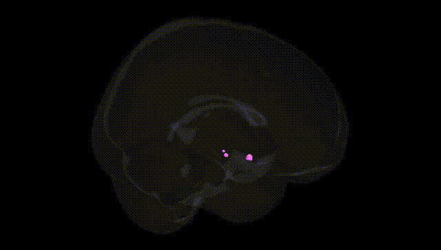 Full Brain Black