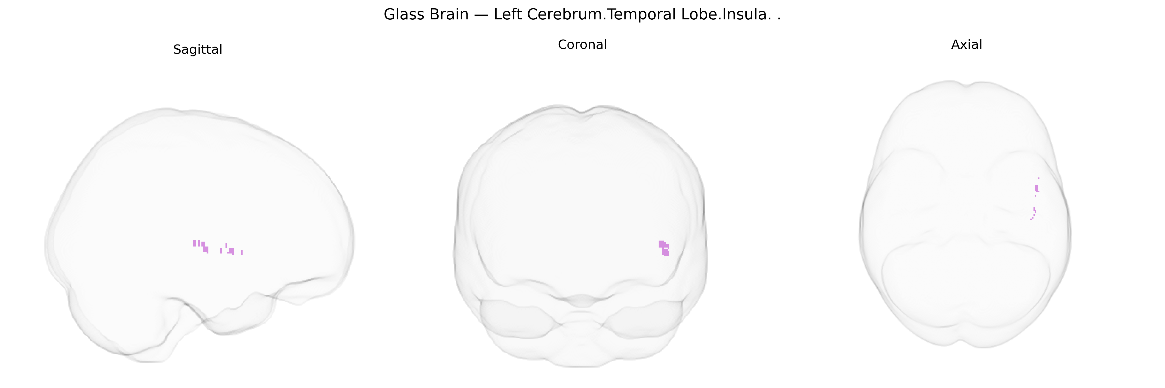 Triplanar Ghost Brain