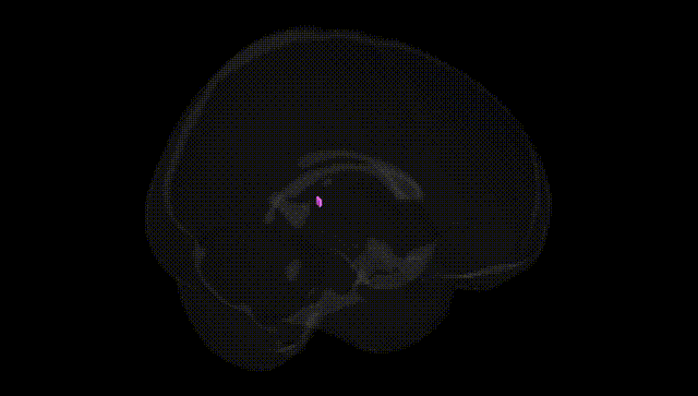 Full Brain Black