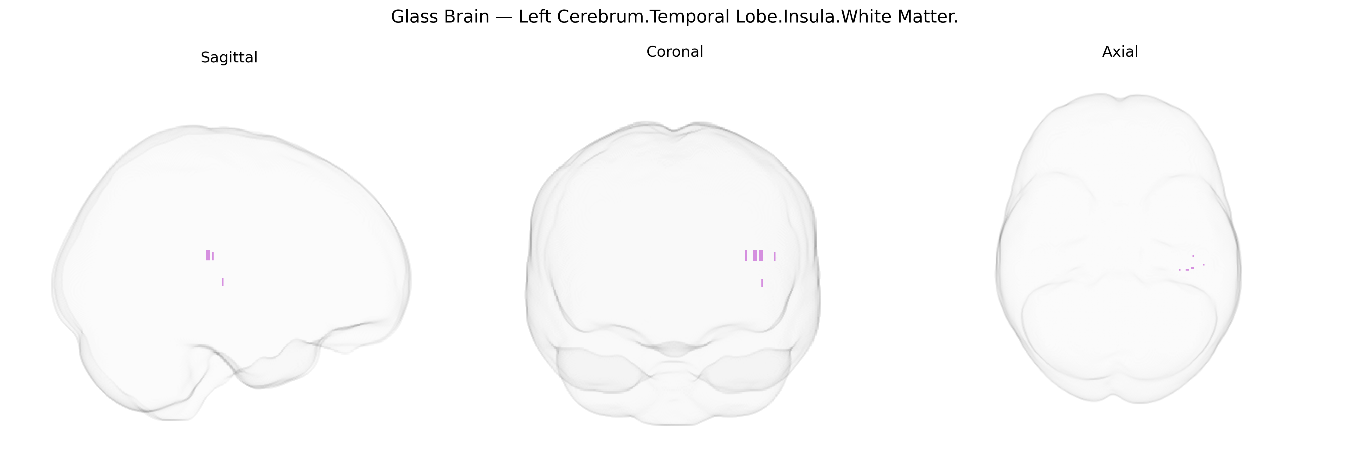 Triplanar Ghost Brain