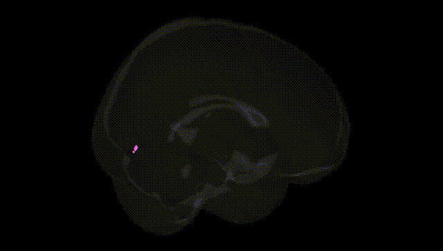 Full Brain Black