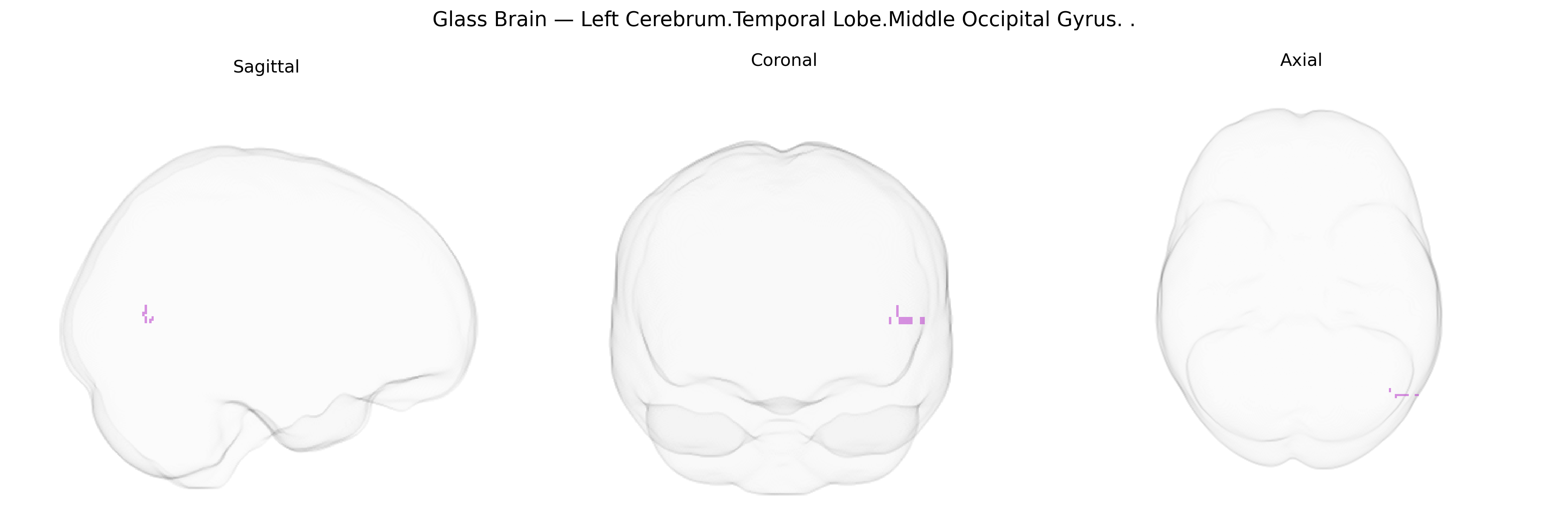 Triplanar Ghost Brain