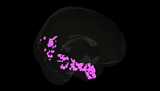Full Brain Black