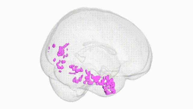 Full Brain White