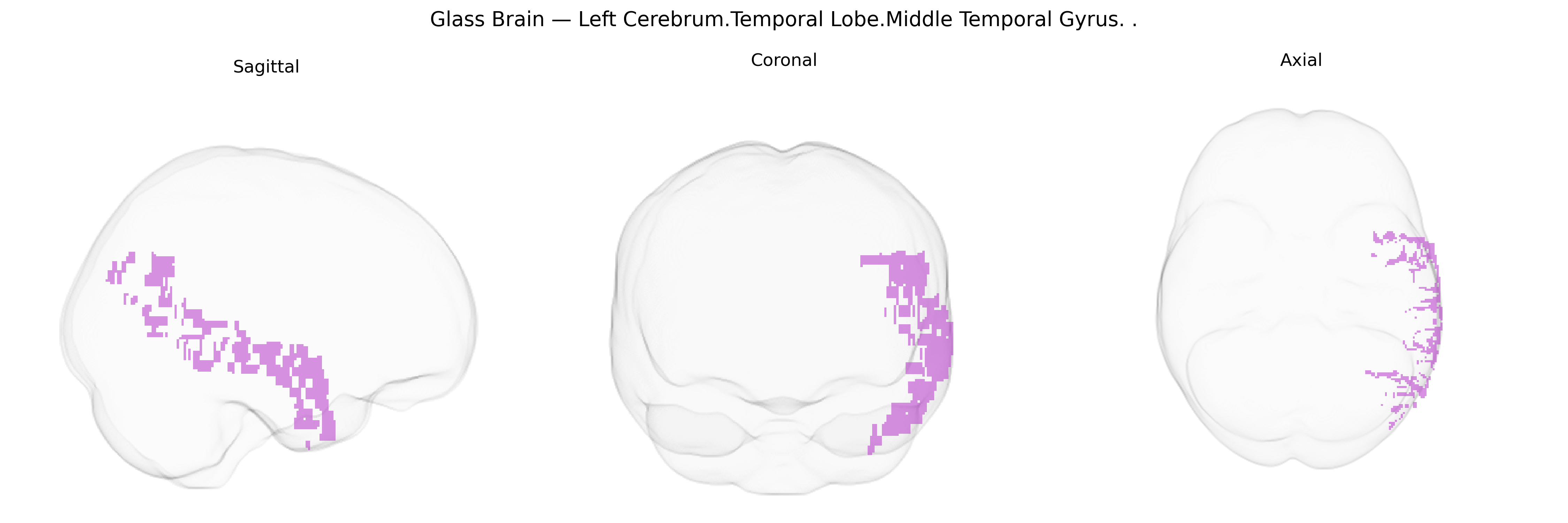 Triplanar Ghost Brain
