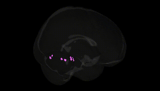 Full Brain Black