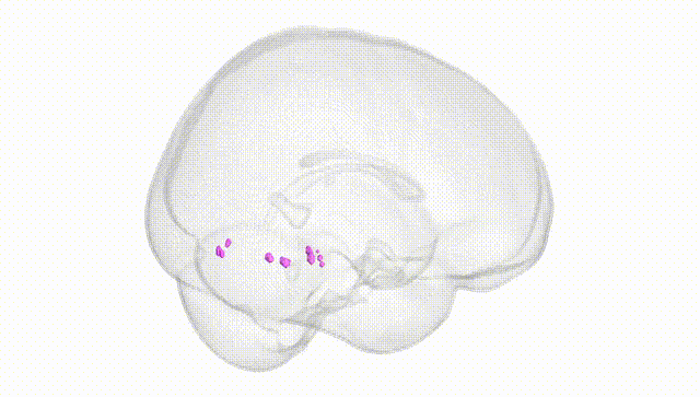 Full Brain White