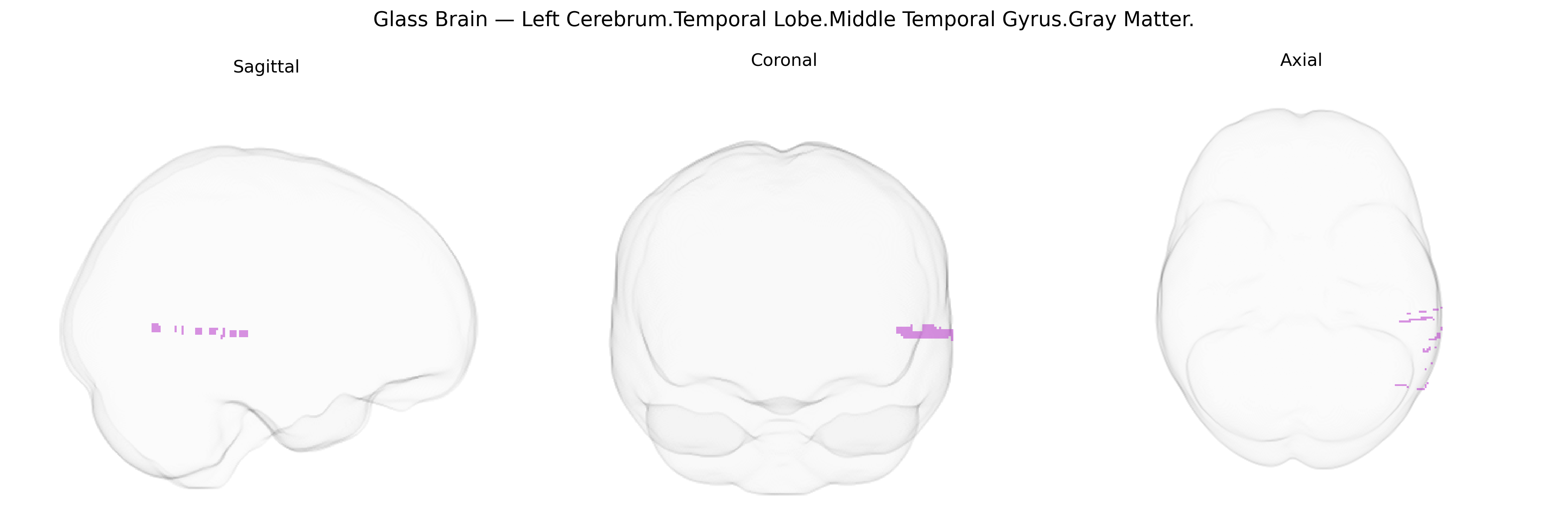 Triplanar Ghost Brain