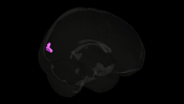 Full Brain Black
