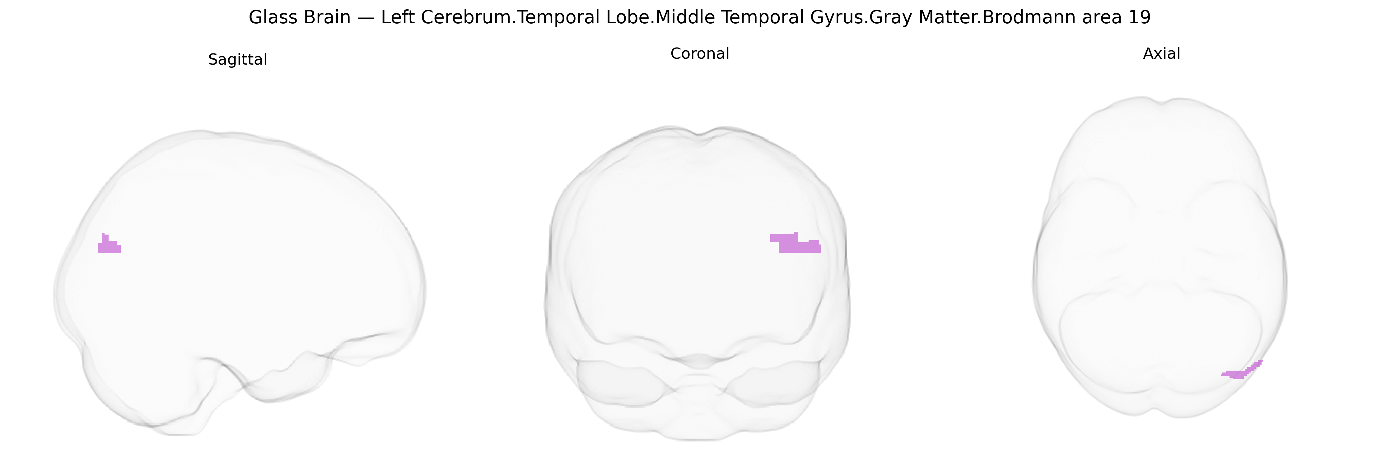 Triplanar Ghost Brain