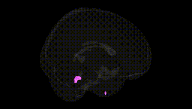 Full Brain Black