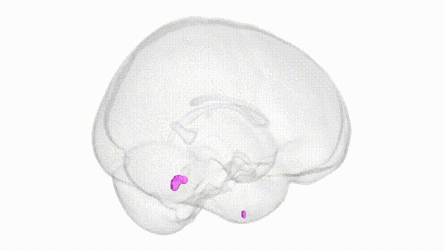 Full Brain White