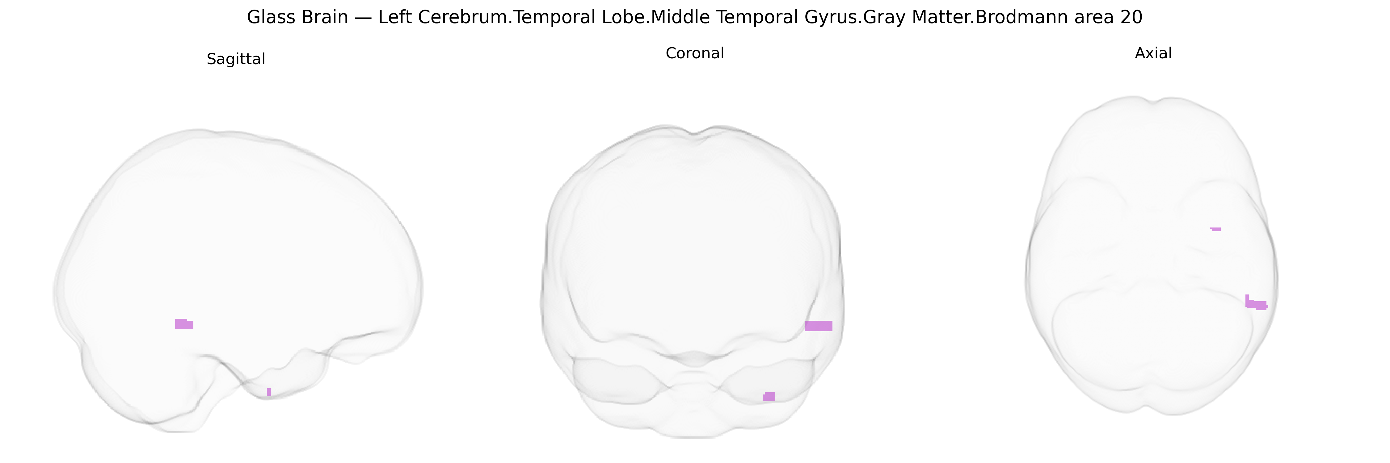 Triplanar Ghost Brain